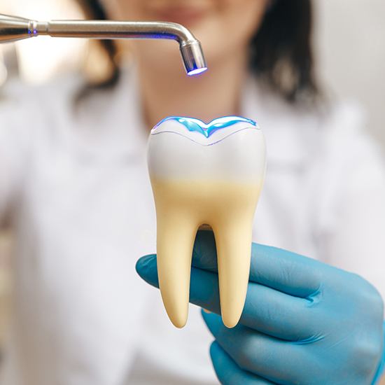 Dentist shining UV light on large model tooth with dental bonding