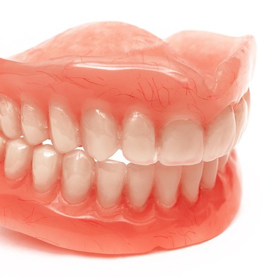 A full set of dentures in Fairfax